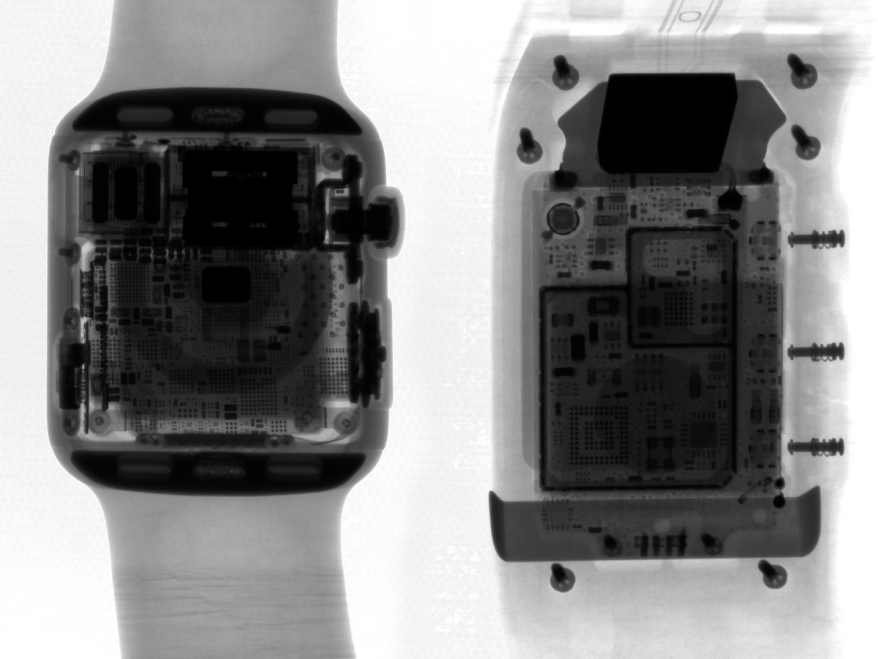 Часы рентгена. Часы в рентгене. Часы x-ray. Apple watch x-ray. Часы под рентгеном.